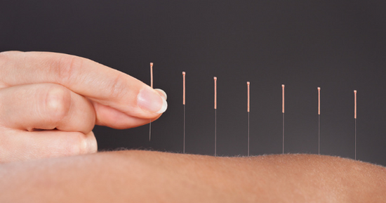Acupuncture for Chemotherapy-Induced Peripheral Neuropathy